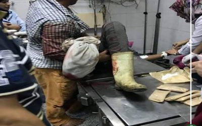 ماكينة زراعية تتسبب في بتر ساق شاب بإحدى قرى طلخا