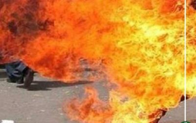 شاب يحرق نفسه لمروره بأزمة نفسيه بدكرنس