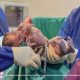 «فوتوسيشن الولادة».. مصورة توثق الثواني الأولى للخروج إلى الحياة