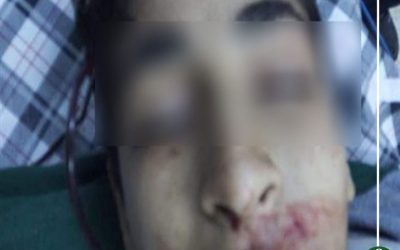 مصرع طفل طعنا في ميت غمر