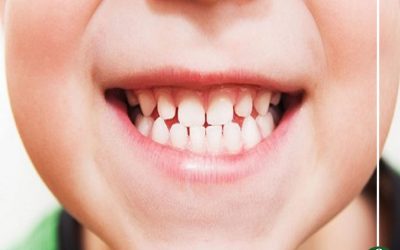مشاكل تصيب أسنانك وكيفية العناية بصحة الفم