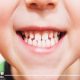 مشاكل تصيب أسنانك وكيفية العناية بصحة الفم
