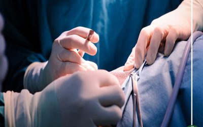 عملية استئصال الرحم أسبابها وهل من بديل؟