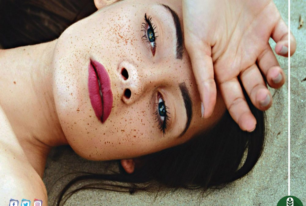 النمش.. أسبابه وعلاجه وقصة ارتباطه بالسحر