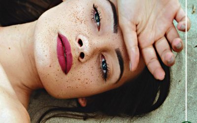النمش.. أسبابه وعلاجه وقصة ارتباطه بالسحر