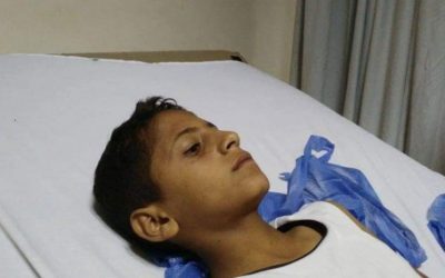 تفاصيل إصابة 4 أطفال في انفجار عبوة ناسفة بالشيخ زويد